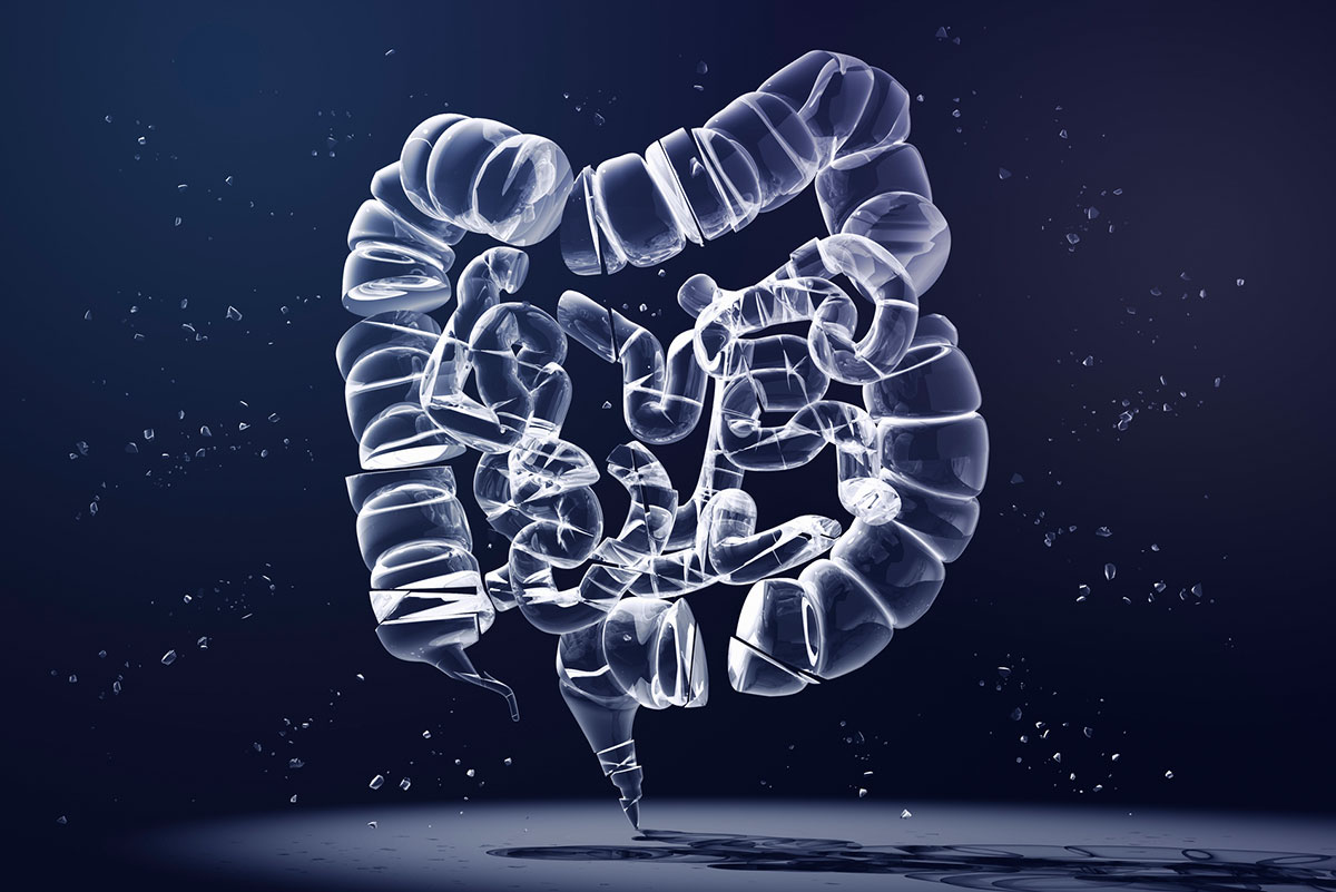 What is Colorectal Cancer and Why Does it Matter?